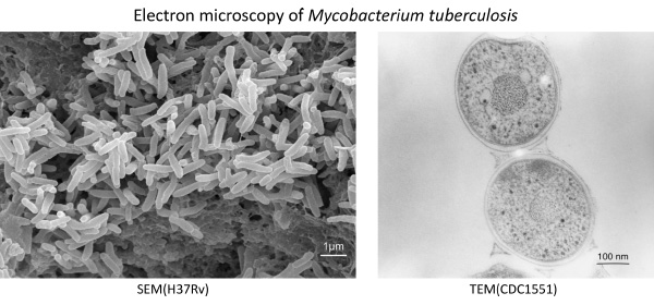 Electron microscopy of Mycrobacterium tuberculosis